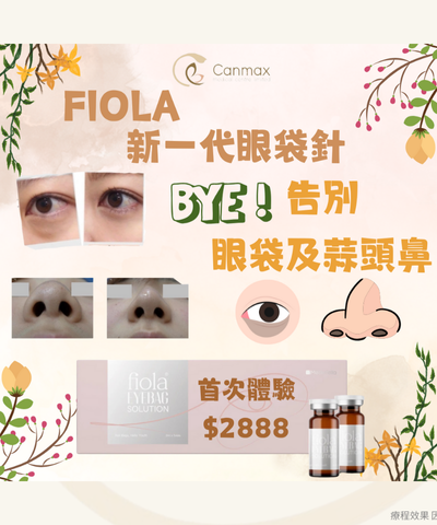 Fiola Eyebag