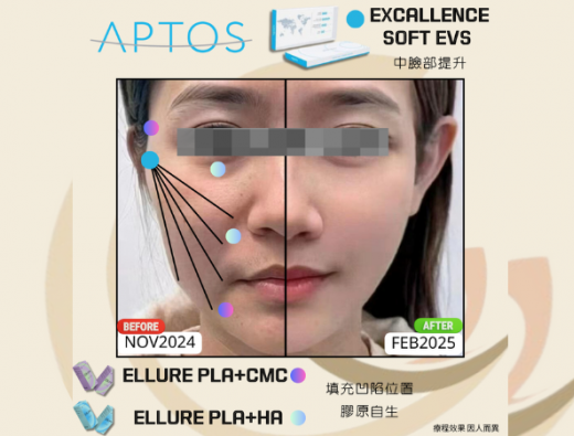 第一次的心型輪廓